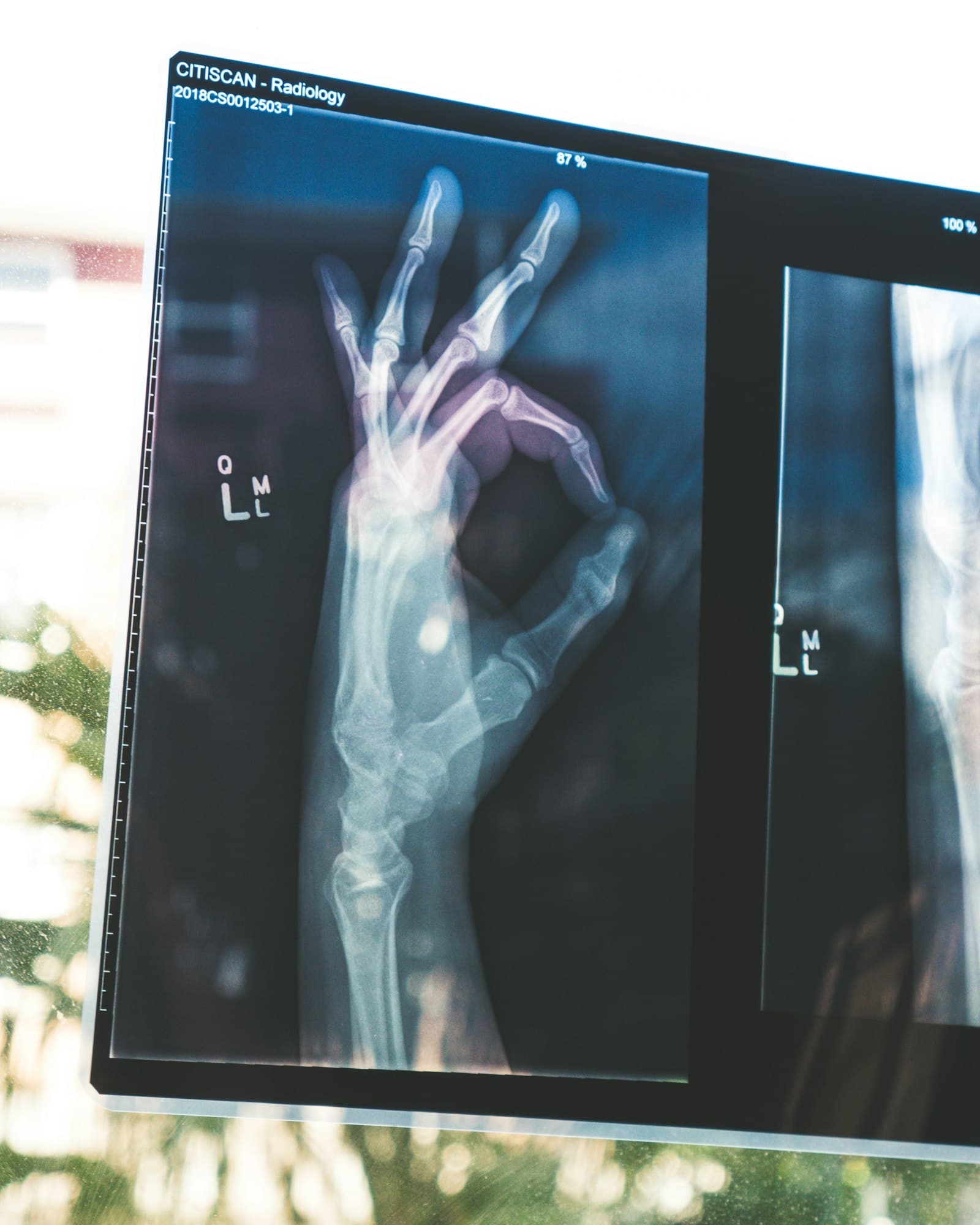 Radiologist reviewing an X-ray study on a diagnostic monitor